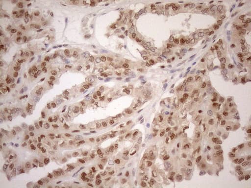 MGMT Antibody (clone OTI5A7)