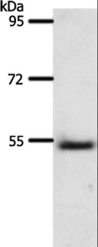 A1BG Antibody