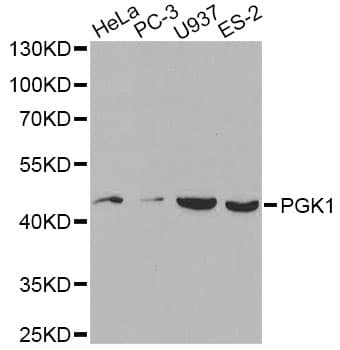 Polyclonal Rabbit anti-Human PGK1 / Phosphoglycerate Kinase Antibody (IHC, WB)