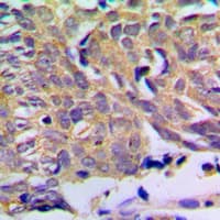 Polyclonal Rabbit anti-Human PXMP2 Antibody (Internal, IHC, WB)