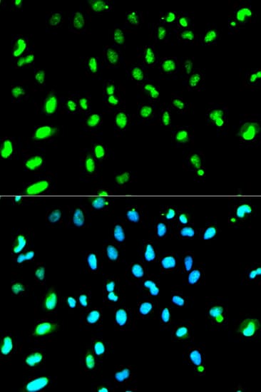 TDP-43 / TARDBP Antibody