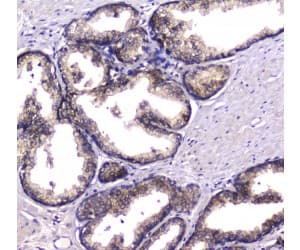 HGD Antibody