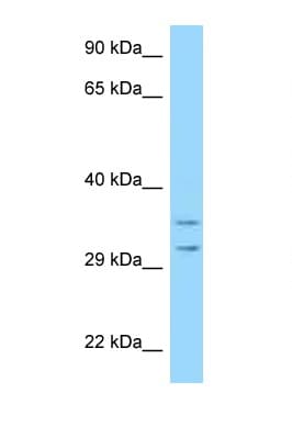 RPS2 / Ribosomal Protein S2 Antibody (aa99-148)