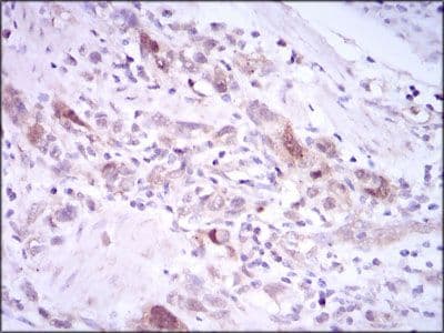 PLK1 / PLK-1 Antibody (Amino Acid: 331-508, clone 3C11)