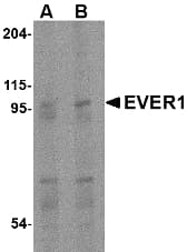 Polyclonal Rabbit anti-Human TMC6 Antibody (IHC, IF, WB)