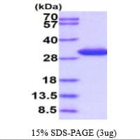Human SPR Protein (Recombinant His)