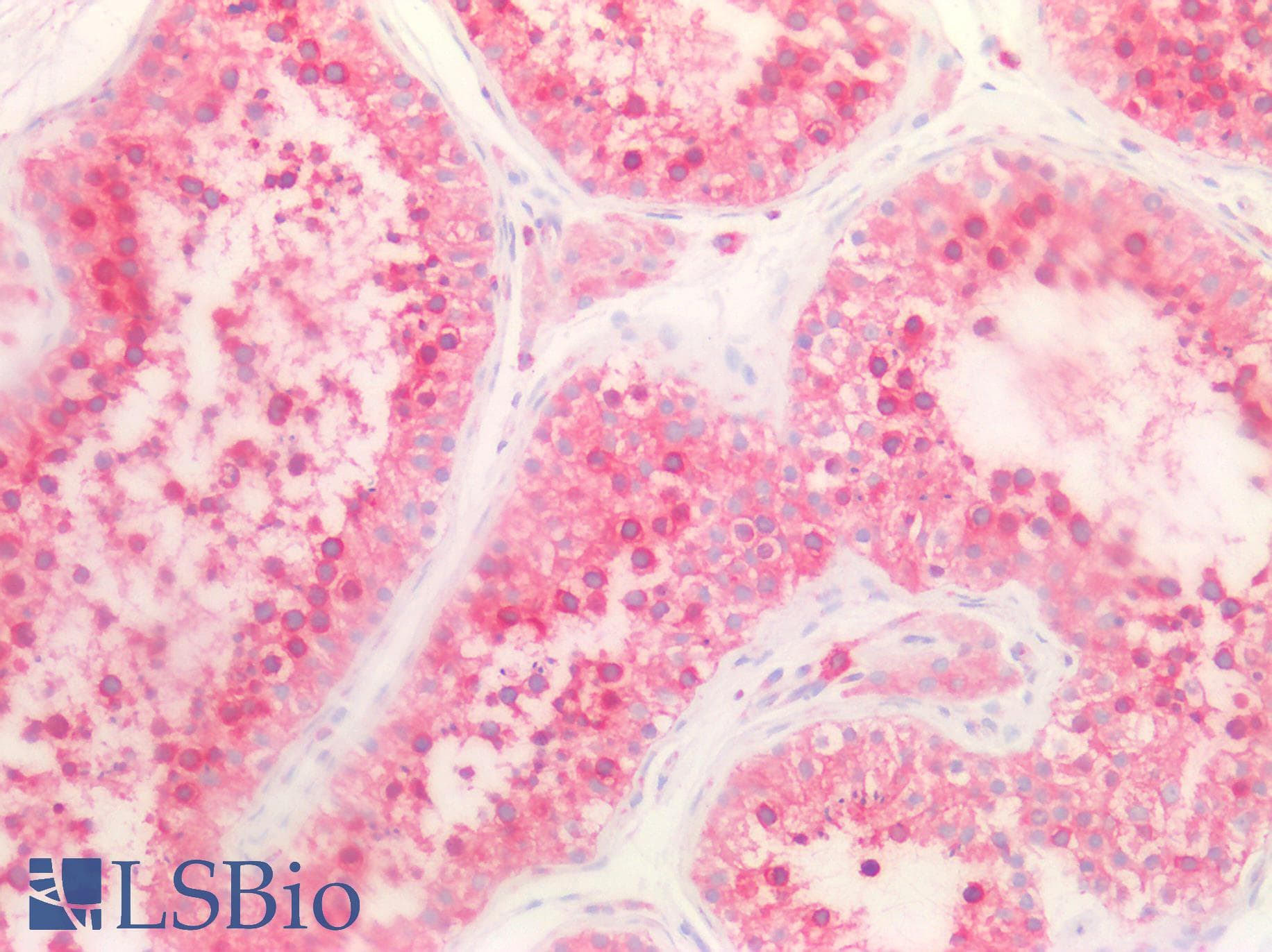 IHC-plus™ Polyclonal Rabbit anti-Human HTR2C / 5-HT2C Receptor Antibody (aa400-450, IHC, IF, WB)