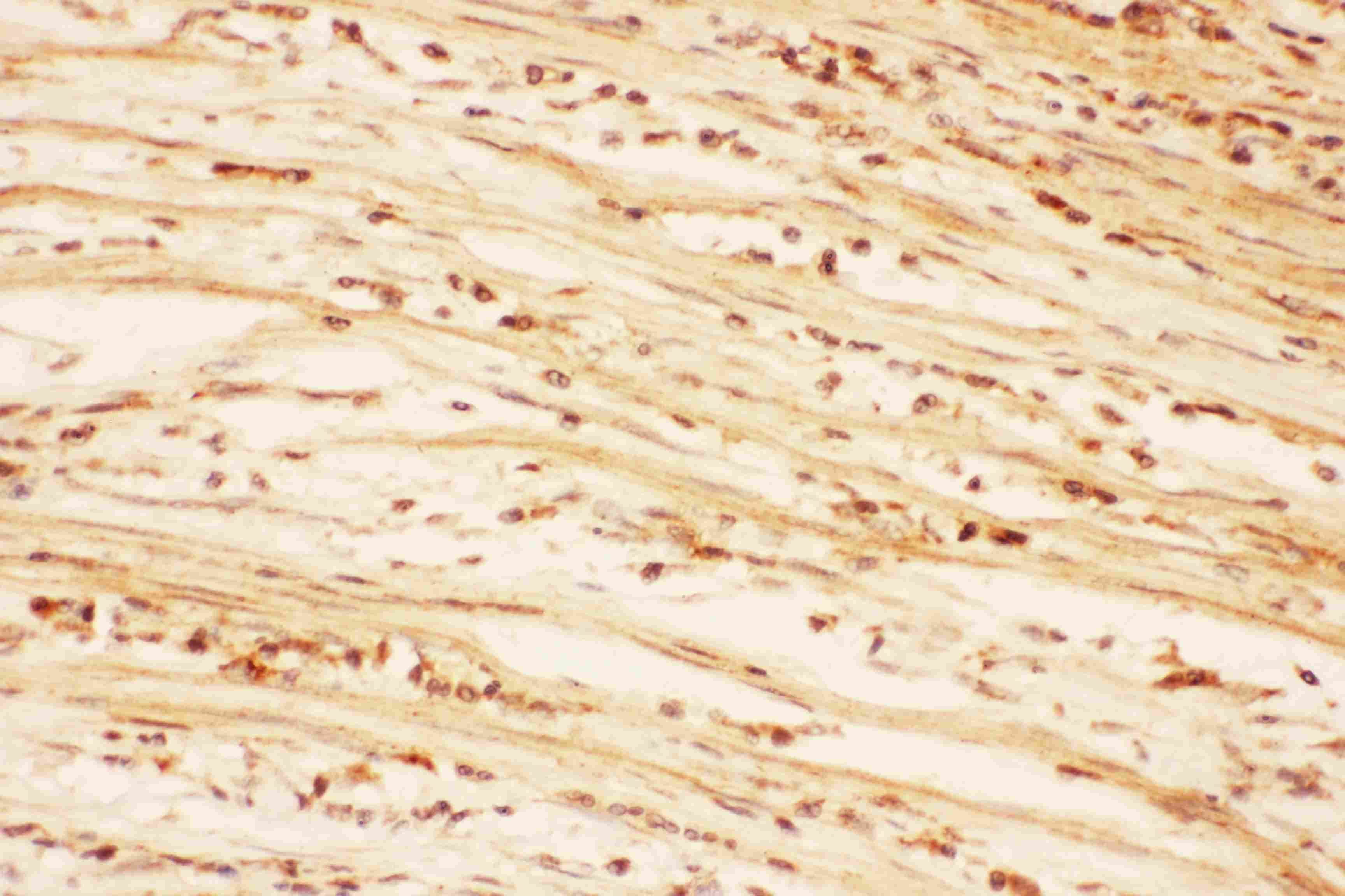 AKT2 Antibody (aa454-481)