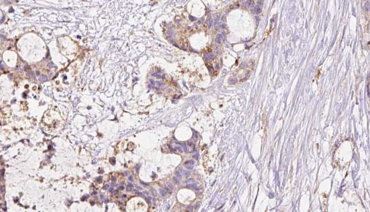 INSR / Insulin Receptor Antibody (phospho-Tyr1361)