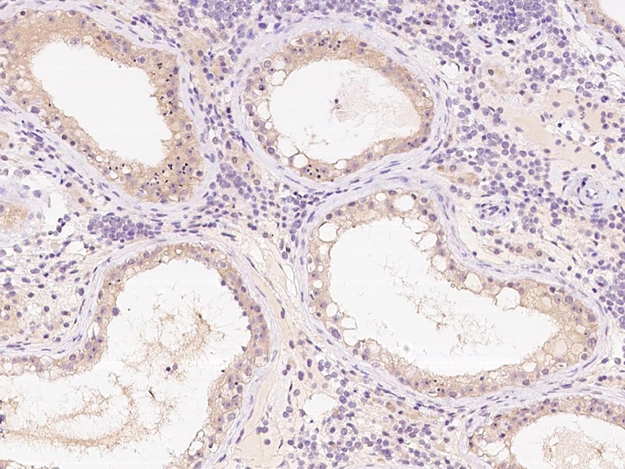Polyclonal Rabbit anti-Human TTC33 Antibody (IHC)