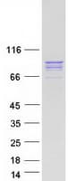 Human MAD1L1 / MAD1 Protein (Recombinant Myc-DDK (Flag))
