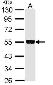 Polyclonal Rabbit anti-Human TRIM21 / RO52 Antibody (aa254-475, IHC, WB)