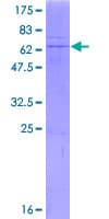 Human B4GALT6 Protein (Recombinant GST)