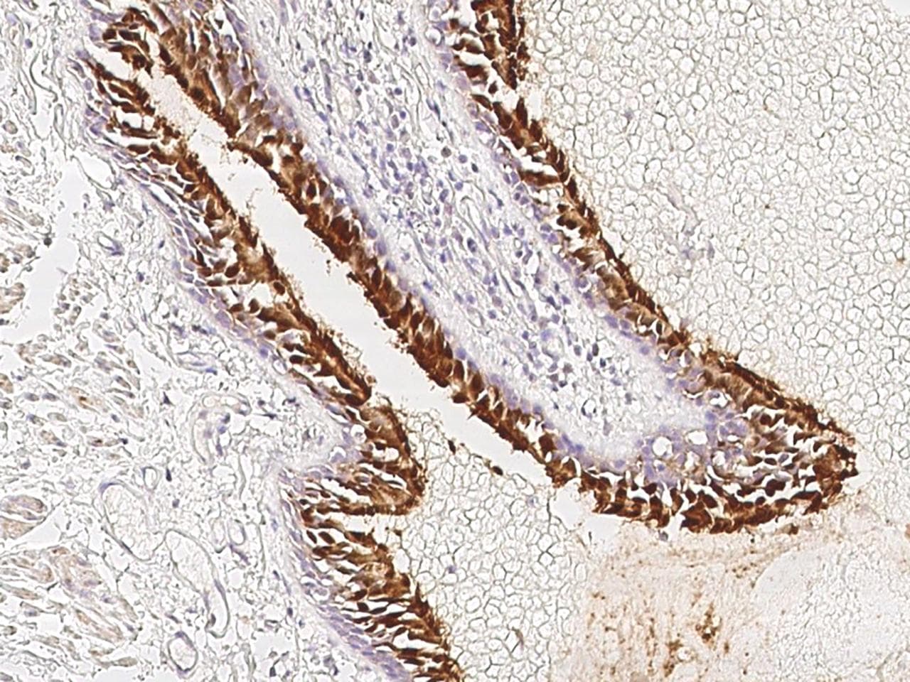 Polyclonal Rabbit anti-Human TRAF3IP1 Antibody (IHC)