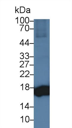 SOD1 / Cu-Zn SOD Antibody (aa2-153, APC)