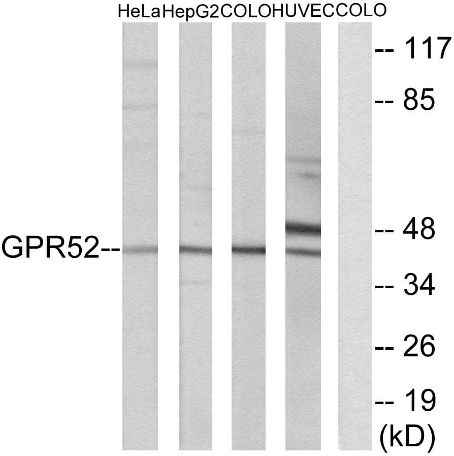 GPR52 Antibody