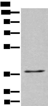 UBAC2 Antibody