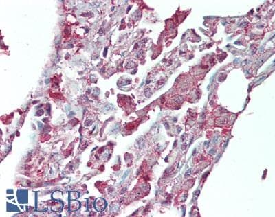 IHC-plus™ HNF1A / HNF1 Antibody (aa50-100)