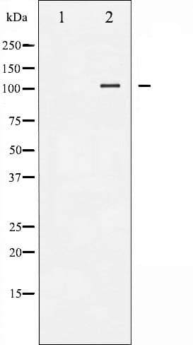 LIPE / HSL Antibody (phospho-Ser552)