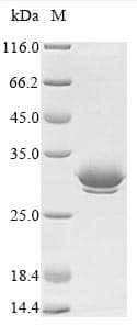 Mistletoe Beta-galactoside-specific lectin 1 Protein (Recombinant 6His, N-terminus)