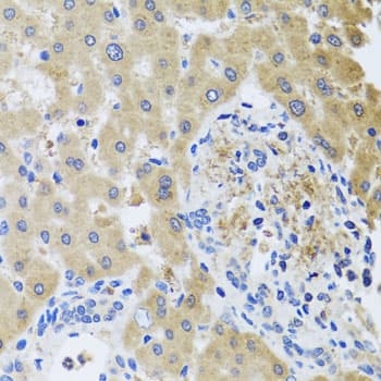 RHOB Antibody