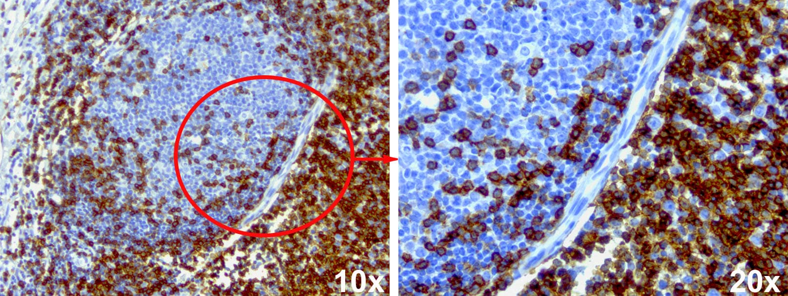 CD5 Antibody (clone UMAB9, Carrier-free)