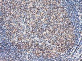 TUBAL3 Antibody (aa150-446, clone OTI1G6, Carrier-free)