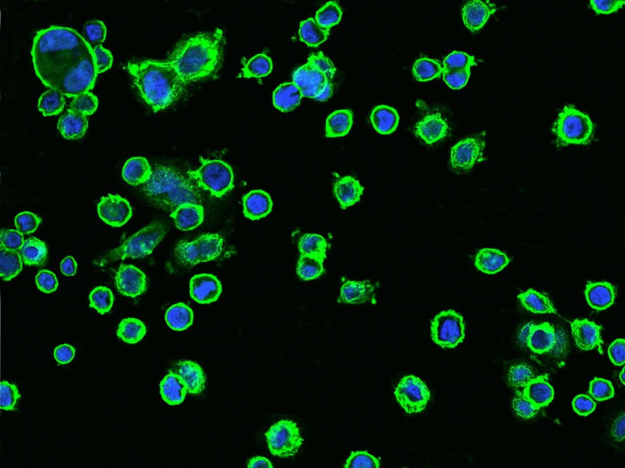 Monoclonal Rabbit anti-Human ERBB2 / HER2 Antibody (clone 002, Preservative Free, aa1-652, IHC, IF)