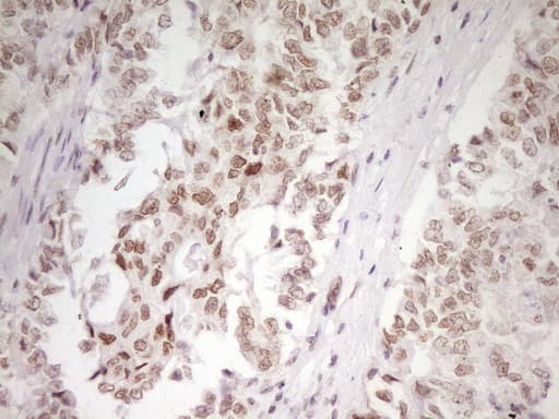 HMG20A Antibody (aa1-281, clone OTI2H4)