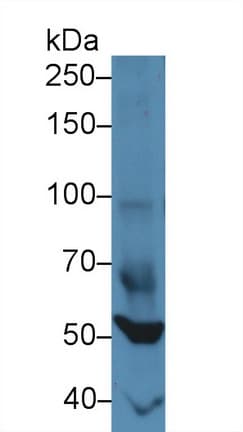 FOXP1 Antibody (aa122-346, Biotin)