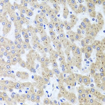 Polyclonal Rabbit anti-Human Adiponectin Antibody (IHC, WB)
