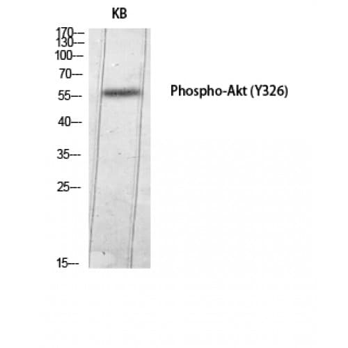 Polyclonal Rabbit anti-Human AKT1 Antibody (270-350 aa, WB)