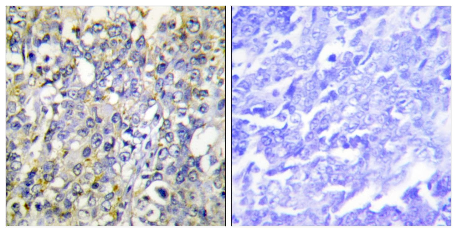 Polyclonal Rabbit anti-Human IGFBP3 Antibody (p183, IHC, WB)