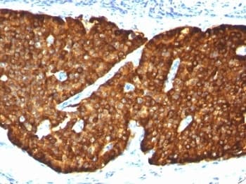 CHGA / Chromogranin A Antibody (clone CGA/413)