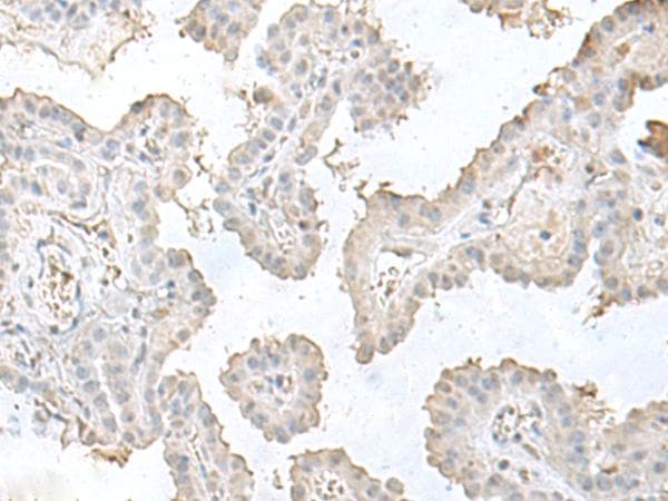 LSM10 Antibody