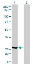 MTHFD2 Antibody (clone 4G7-2G3)