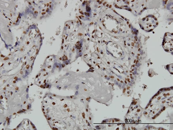 Monoclonal Mouse anti-Human ARID1B / BAF250B Antibody (clone 2F2, IHC, IF, WB)
