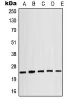 CRYAB / Alpha B Crystallin Antibody (phospho-Ser19)