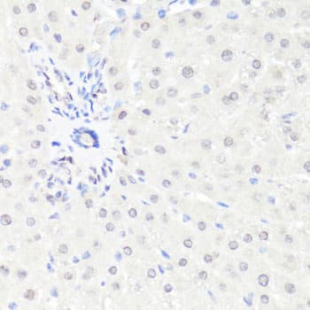EGFR Antibody