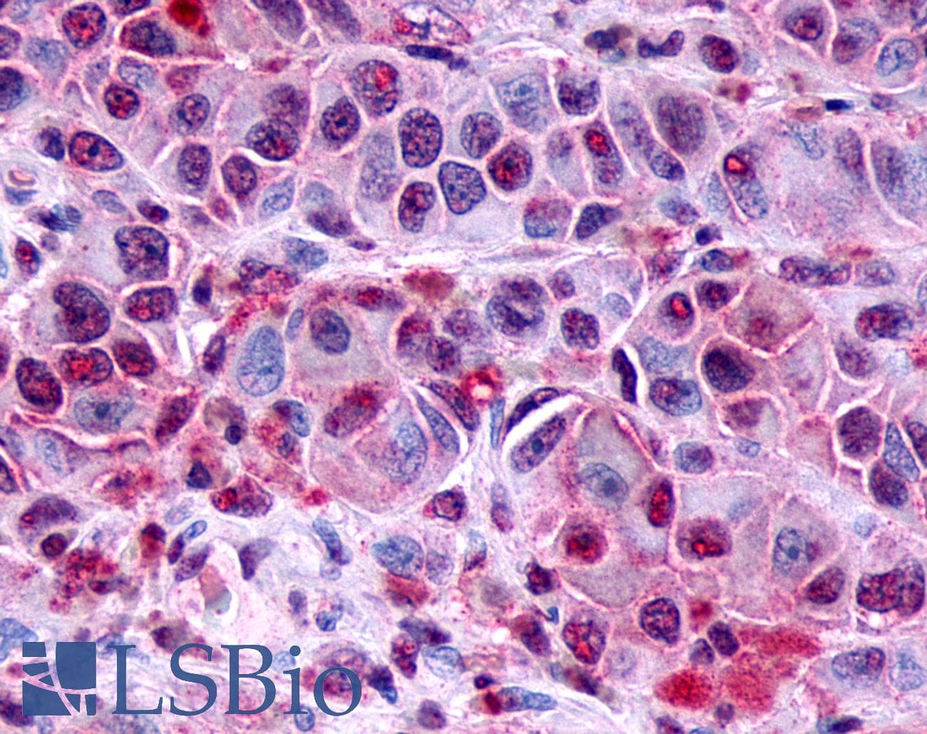 PathPlus™ FZD8 / Frizzled 8 Antibody (N-Terminus)