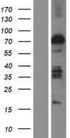ABLIM2 Protein (Over-Expression Lysate Myc-DDK (Flag))