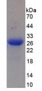Human MASP2 / MASP-2 Protein (Recombinant His, N-Terminal)