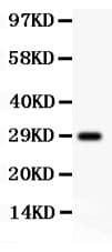 APP / Beta Amyloid Precursor Antibody (aa672-713)