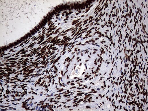 SH3BGRL Antibody (clone OTI8F7)