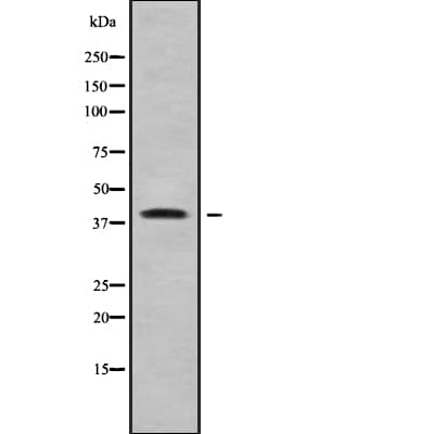 Polyclonal Rabbit anti-Human WNT7B Antibody (IHC, WB)