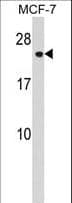CHMP1A Antibody (aa34-61)