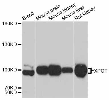 Polyclonal Rabbit anti-Human XPOT / Exportin-T Antibody (WB)