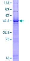 Human RNFT1 Protein (Recombinant GST)