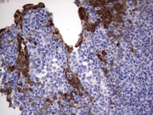 S100A9 / MRP14 Antibody (clone OTI8G1)