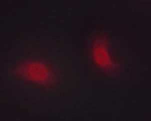 CHEK1 / CHK1 Antibody (phospho-Ser286)